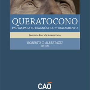 Queratocono. Pautas para su diagnóstico y tratamiento.