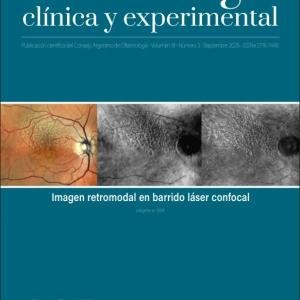 Resultados visuales a corto plazo con la lente intraocular Magnificent: un estudio exploratorio en población argentina